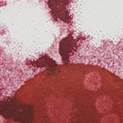 rote Sonne, weisse Blüten, rosa gesprenkelter Hintergrund